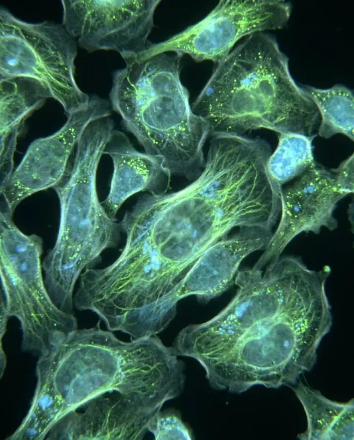 Microscope image of cells stained lime green and blue
